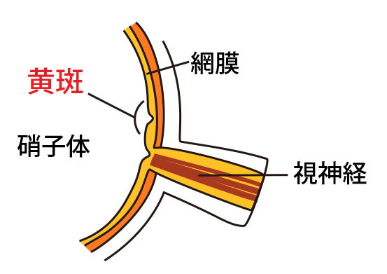 白内障とは
