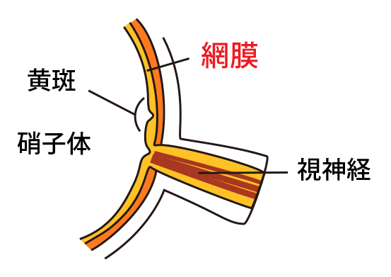 白内障とは