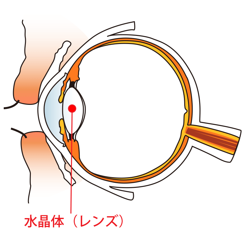 白内障とは